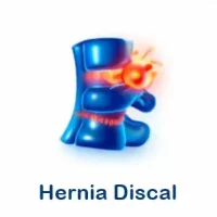 hernia discal