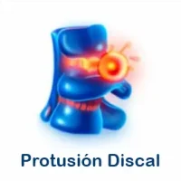 protusion discal