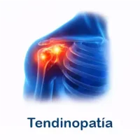 tendinopatia
